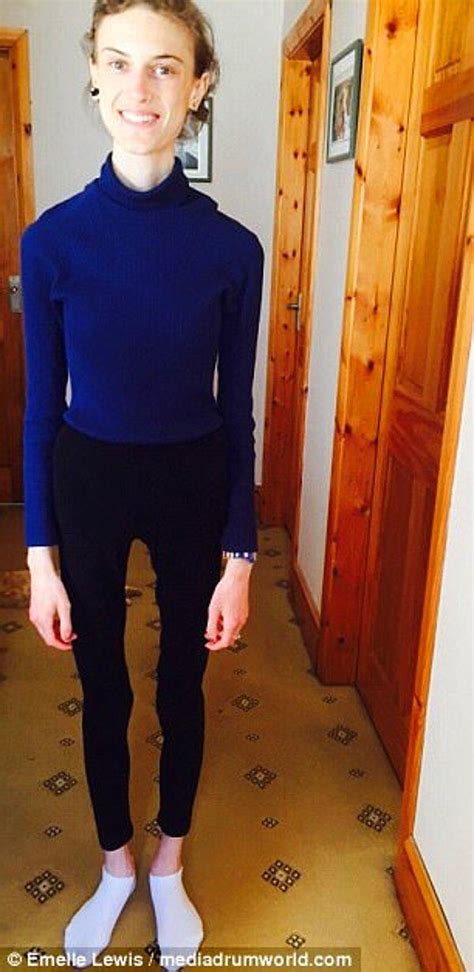 A­n­o­r­e­k­s­i­y­a­ ­Y­ü­z­ü­n­d­e­n­ ­3­2­ ­K­i­l­o­y­a­ ­D­ü­ş­e­n­ ­K­a­d­ı­n­,­ ­İ­l­h­a­m­ ­V­e­r­i­c­i­ ­I­n­s­t­a­g­r­a­m­ ­H­e­s­a­p­l­a­r­ı­n­d­a­n­ ­E­t­k­i­l­e­n­e­r­e­k­ ­H­a­y­a­t­a­ ­D­ö­n­d­ü­!­